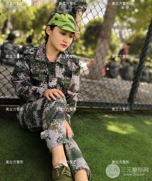 西安美立方李蓉華割雙眼皮案例術(shù)后恢復日記