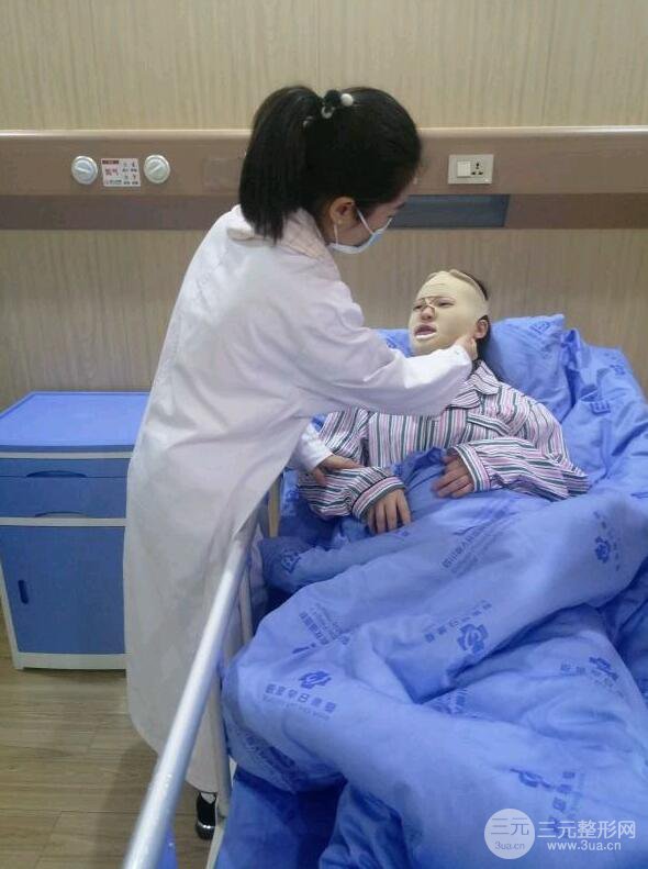 下頜角切除手術(shù)前后恢復(fù)對比圖過程分享