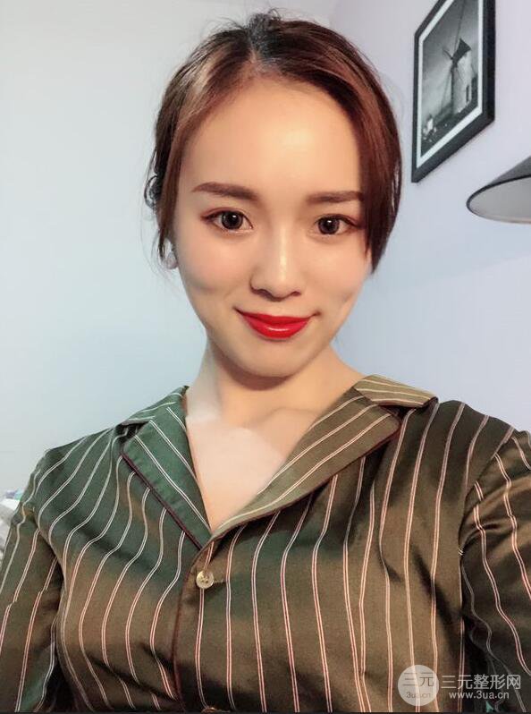 下頜角切除手術(shù)前后恢復(fù)對比圖過程分享