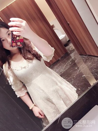 福州美貝爾吸脂案例分享