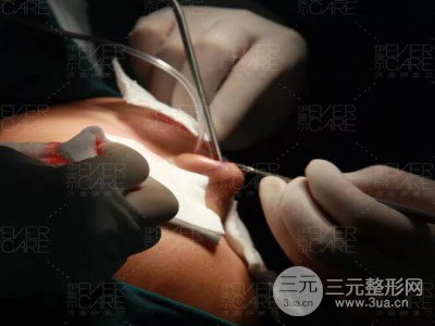 北京伊美爾徐軍假體隆鼻前后對(duì)比照片心情日記