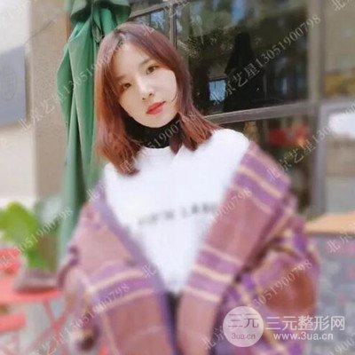 北京藝星隆鼻整形案例前后對(duì)比圖分享~