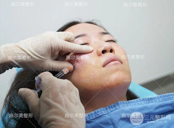 南京施爾美玻尿酸注射案例,讓蘋果肌嘭嘭嘭！