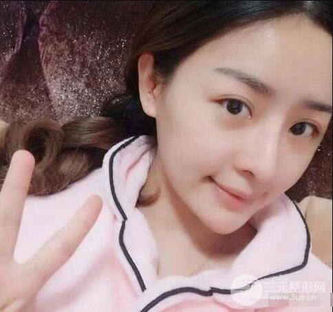 吉林銘醫(yī)李紅肋骨隆鼻整形前后對比圖果恢復心情小札