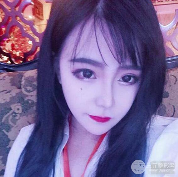 合肥壹加壹甘泉涌軟骨隆鼻前后對(duì)比圖|內(nèi)附真人案例恢復(fù)過(guò)程