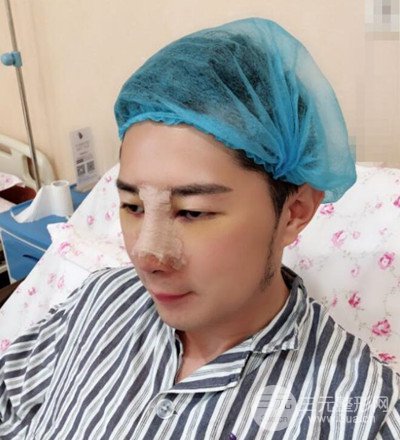 肋軟骨隆鼻整形案例分享，在深圳雅涵做的!