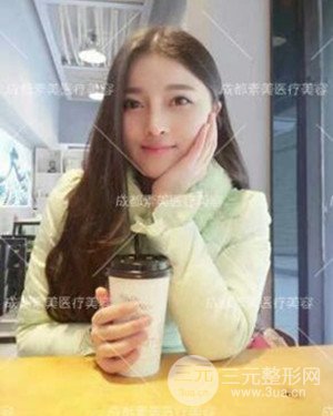 成都素美假體隆鼻案例前后對(duì)比圖分享!