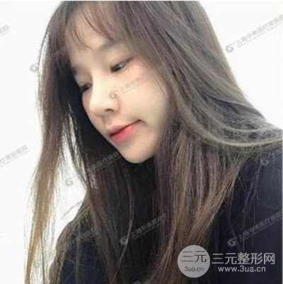 上海華美李志海隆鼻整形案例前后對(duì)比圖分享~