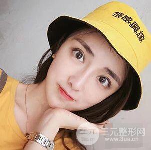 杭州格萊美張樹功假體隆鼻前后對(duì)比圖|內(nèi)附恢復(fù)心情變化哦