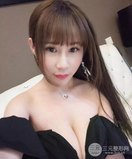 北京玉之光王明利自體脂肪豐胸案例