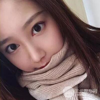 硅膠假體隆鼻案例前后對比圖分享！顏值變化驚人！