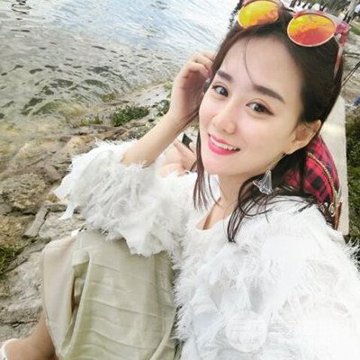 廣州韓妃李光琴隆鼻失敗修復(fù)前后對(duì)比圖分享！