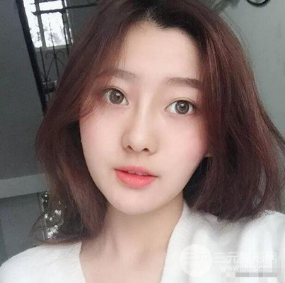 南京華美隆鼻整形前后對(duì)比圖分享