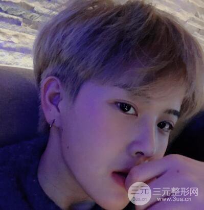 哈醫(yī)大二院整形科肖志波割雙眼皮對(duì)比圖男性案例