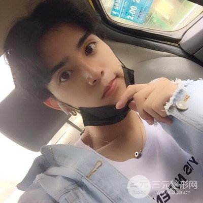 成都蜀尚蓉雅陳建華隆鼻整形前后對比照分享~