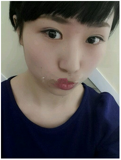 雙眼皮讓眼睛更有神