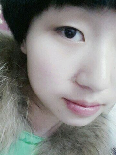 雙眼皮讓眼睛更有神