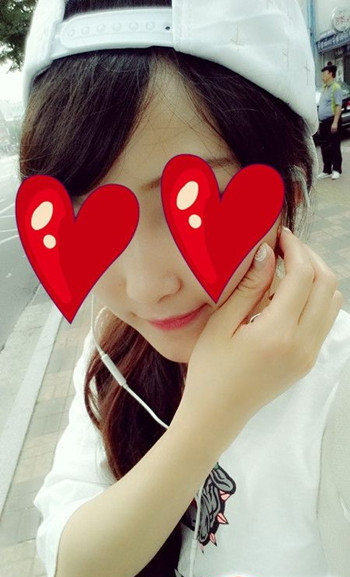 注射打玻尿酸隆鼻前后對比果照片圖 注射打玻尿酸隆鼻可以能夠維持多久