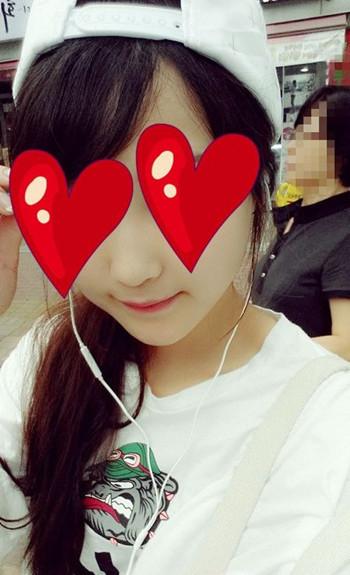 注射打玻尿酸隆鼻前后對比果照片圖 注射打玻尿酸隆鼻可以能夠維持多久