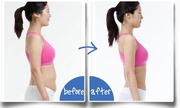 哪些人不能做腰腹吸脂手術(shù) 腰腹吸脂手術(shù)后如何護理