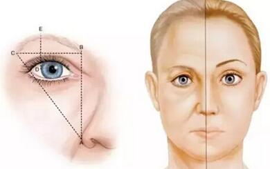 切眉術(shù)后如何快速消腫