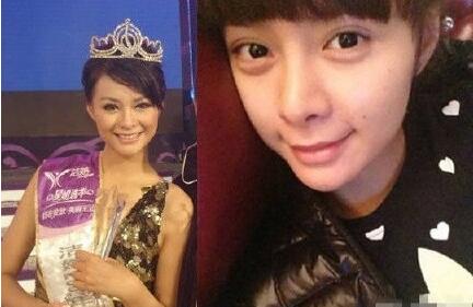 沈夢辰,個人,資料,整容,前后,對比