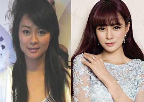 沈夢辰,個人,資料,整容,前后,對比