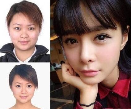 沈夢辰,個人,資料,整容,前后,對比