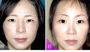 全新眉毛美容整形圖片