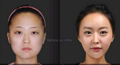 全新眉毛美容整形圖片