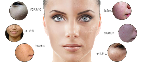 光子嫩膚,會結(jié)痂嗎