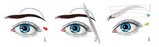 切眉手術(shù)前后對(duì)比照片