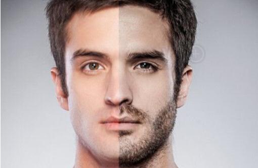 胡須移植,大概要,多少錢