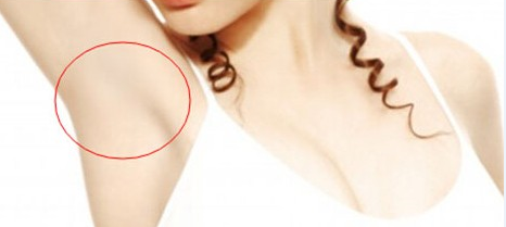 廣州,微創(chuàng),去除腋臭,多少錢(qián)