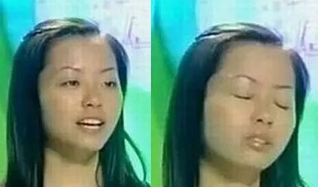 張靚穎整容了嗎 張靚穎整容前后照片對比