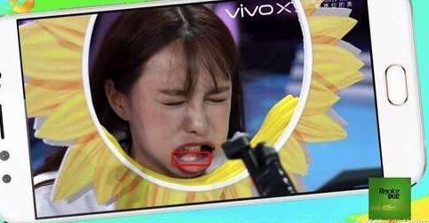 沈夢(mèng)辰整容對(duì)比圖 下巴塞的假體被發(fā)現(xiàn)