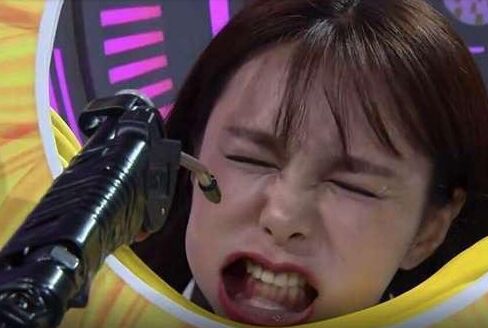 沈夢(mèng)辰整容對(duì)比圖 下巴塞的假體被發(fā)現(xiàn)