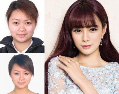 沈夢(mèng)辰整容對(duì)比圖 下巴塞的假體被發(fā)現(xiàn)