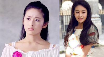 穎兒疑因整容失敗導(dǎo)致嘴部歪斜