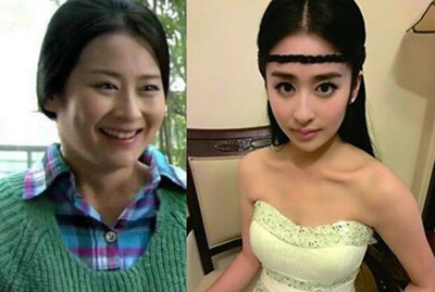 穎兒疑因整容失敗導(dǎo)致嘴部歪斜