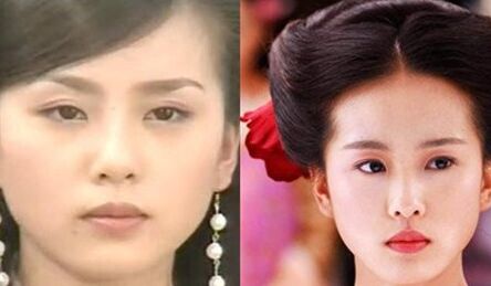 劉詩詩大餅?zāi)樧凒Z蛋臉 劉詩詩整容對比圖