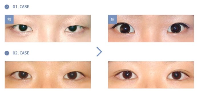 重慶天妃整形美容醫(yī)院新版項目價格表爆出