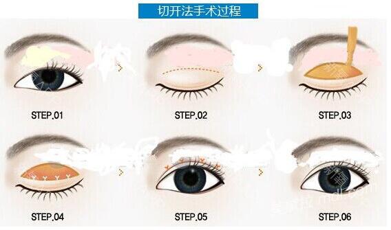 重慶美伽整形醫(yī)院價(jià)格表全新抄底價(jià)