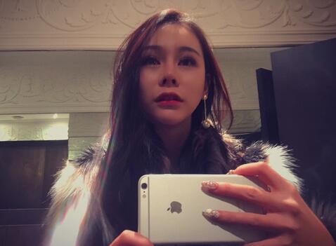 成都天使之翼做隆鼻整形改變了我的塌鼻子 果真的很不錯(cuò)