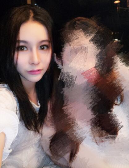 成都天使之翼做隆鼻整形改變了我的塌鼻子 果真的很不錯(cuò)