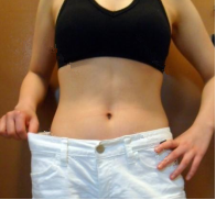 抽脂減肥瘦小腹 終于可以不用節(jié)食鍛煉了