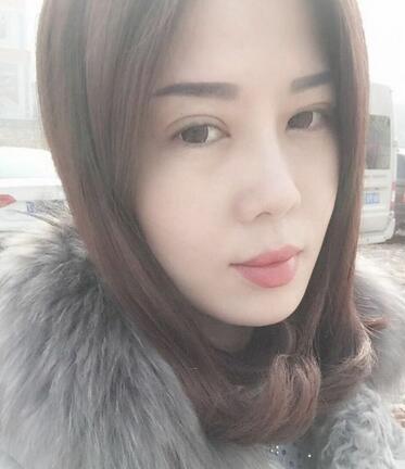 雙眼皮恢復(fù)記錄 果很滿意~