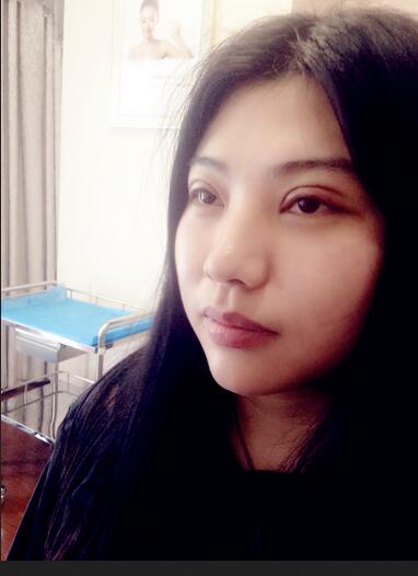 全切雙眼皮后 走向女神之路