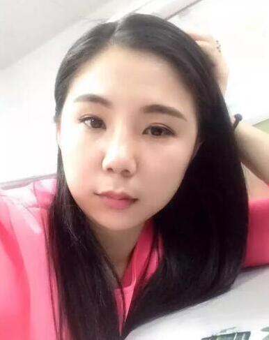 項昌峰醫(yī)生做的隆鼻整形速來看看果怎么樣