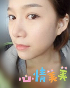 光子嫩膚 我的皮膚也可以白皙Q彈啦~